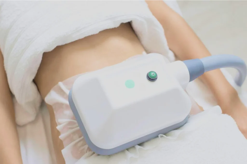 How Fat Freezing and HIFU Work Together? 3 advantages to combining Fat Freezing and HIFU Peterborough