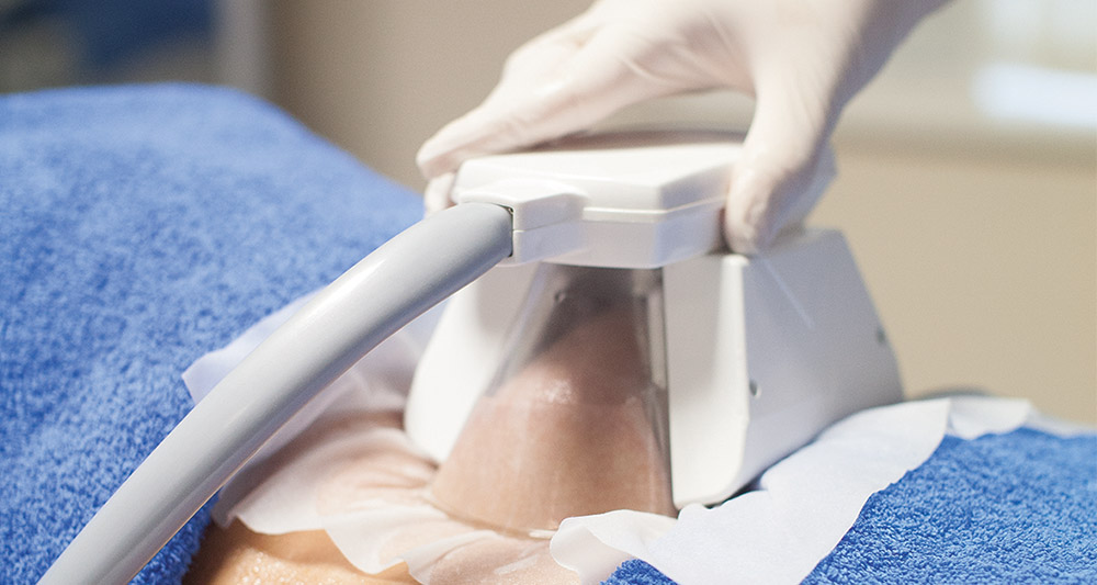 How Fat Freezing and HIFU Work Together? 2 Multiple Areas in One Session HIFU and Fat Freezing Peterborough