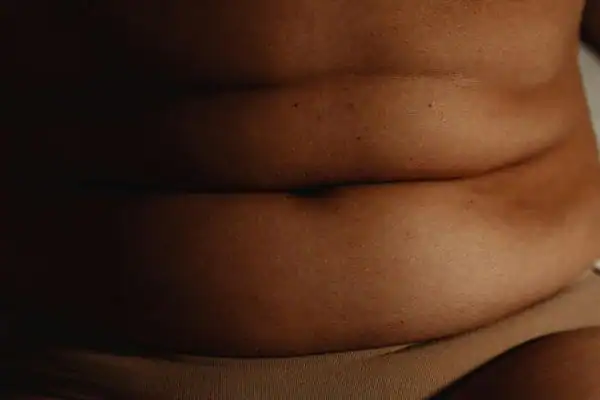 The Hidden Connection: How Stress Shapes Your Fitness and Body Composition 3 image of what stress can do on the stomach area and how Lipo 360 Peterborough can help to change your body shape.